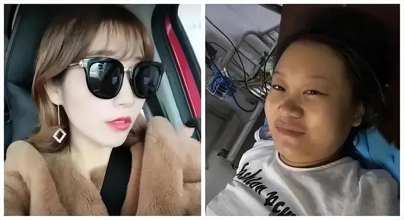  抗衰老干预方案：解析产后机能重构与自我修复逻辑 情感心理