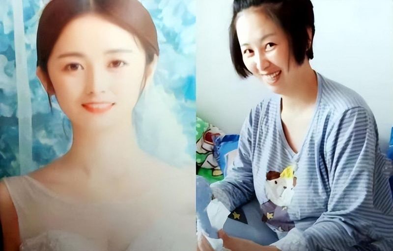  抗衰老干预方案：解析产后机能重构与自我修复逻辑 情感心理